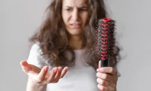 Queda de Cabelo: Causas, Tratamentos e Como Prevenir